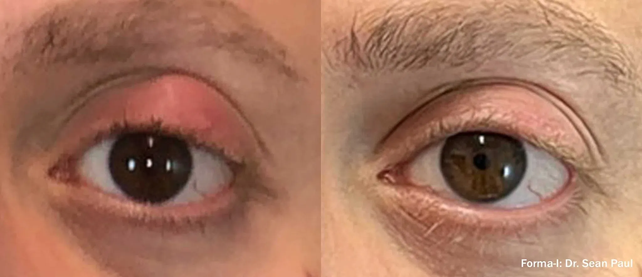 eye-treatment items