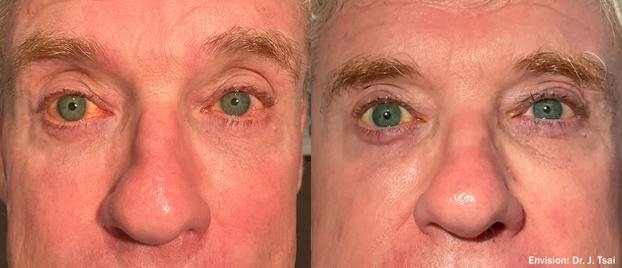 eye-treatment items