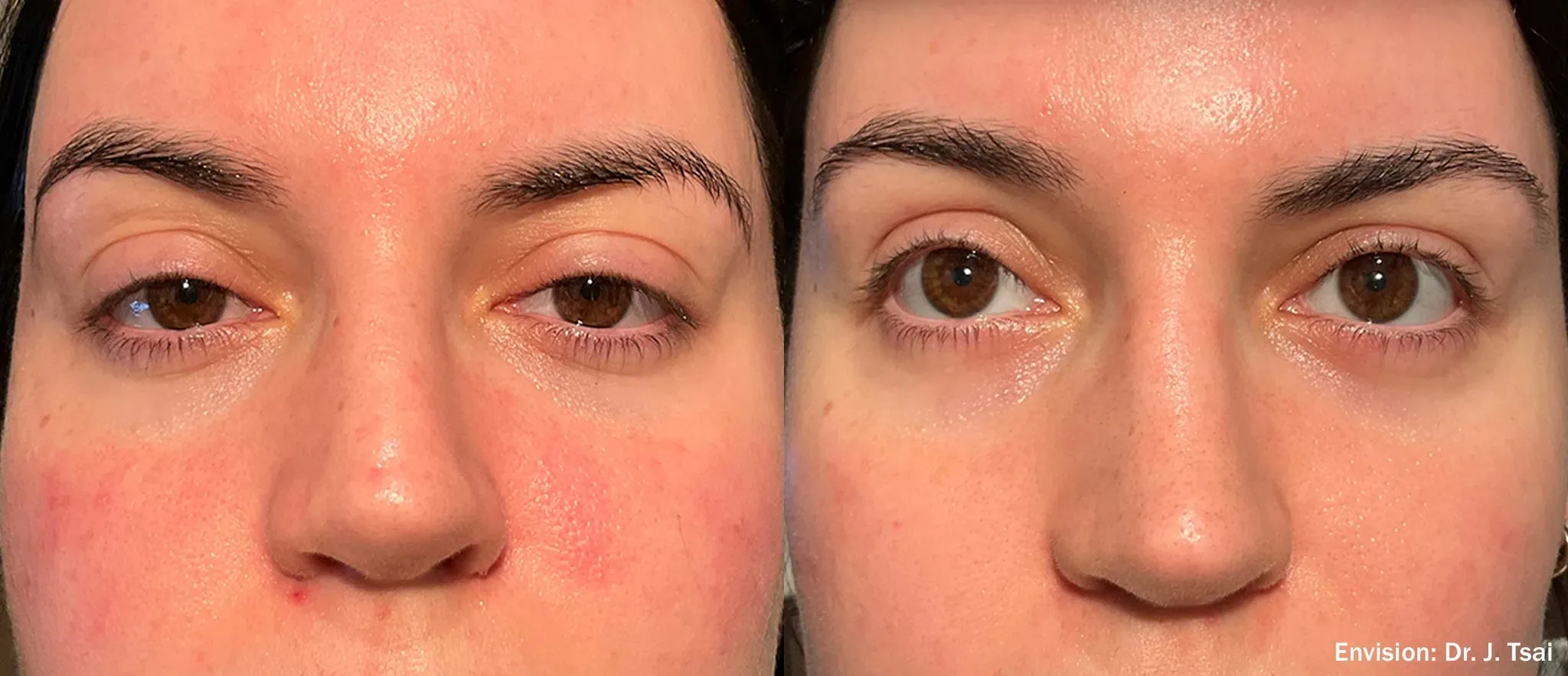eye-treatment items